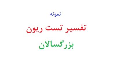 تفسیر تست ریون بزرگسالان