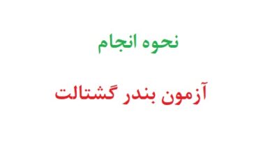 نحوه انجام آزمون بندر گشتالت