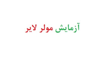آزمایش مولر لایر