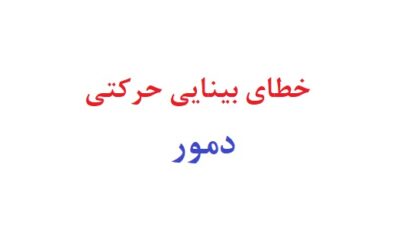 خطای بینایی حرکتی دمور